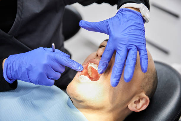 Best Dental Abscess Treatment in Harrison, MI